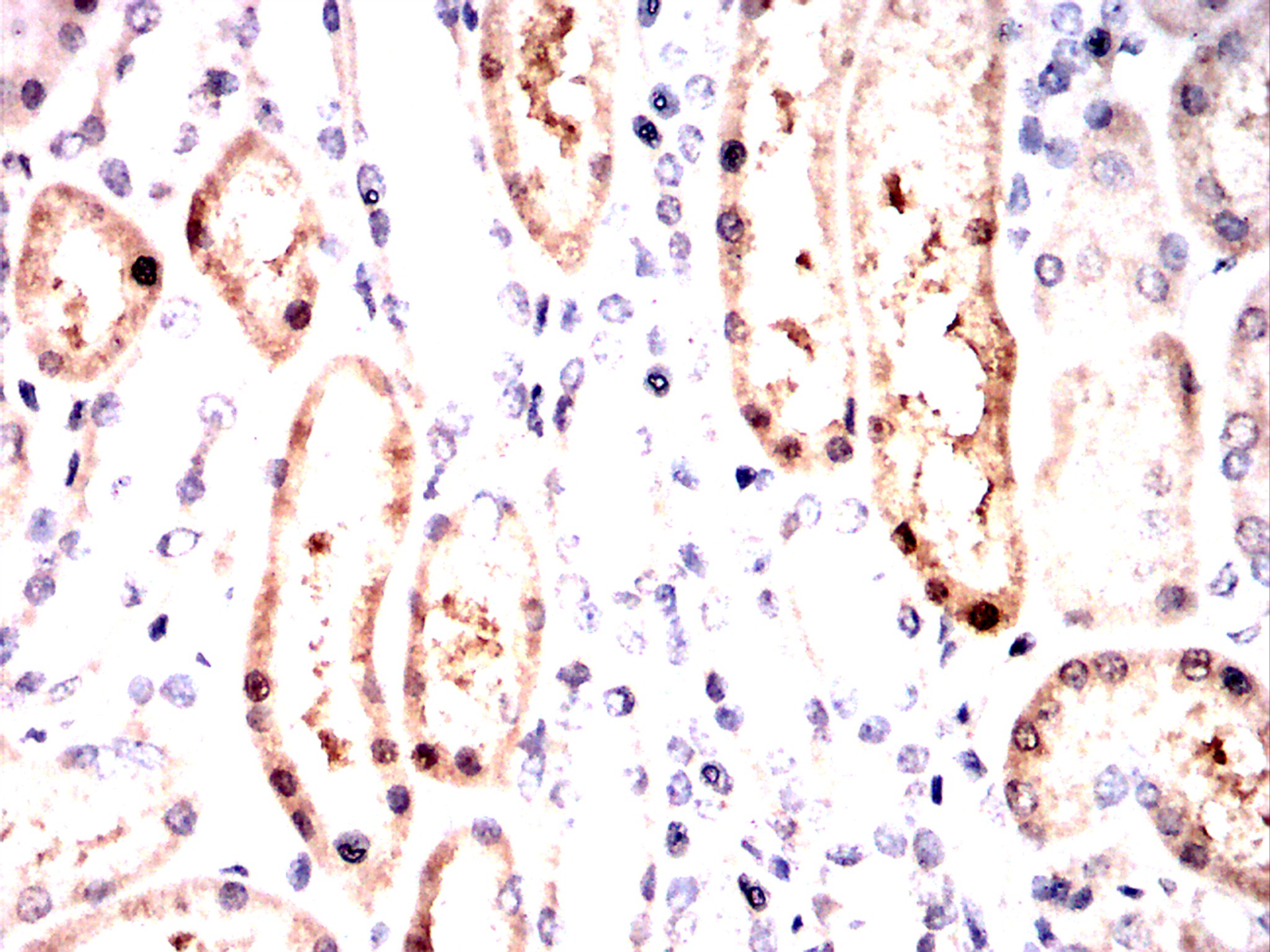 IHC